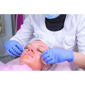 Chemical peel for acne scars